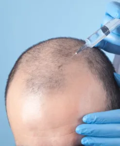 PRP treatment for hair and face