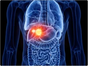 What are tumours? A brief description of tumors.